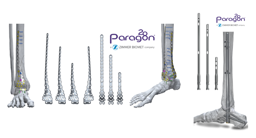 Zimmer Biomet Unveils New Foot and Ankle Solutions for Complex Trauma Cases